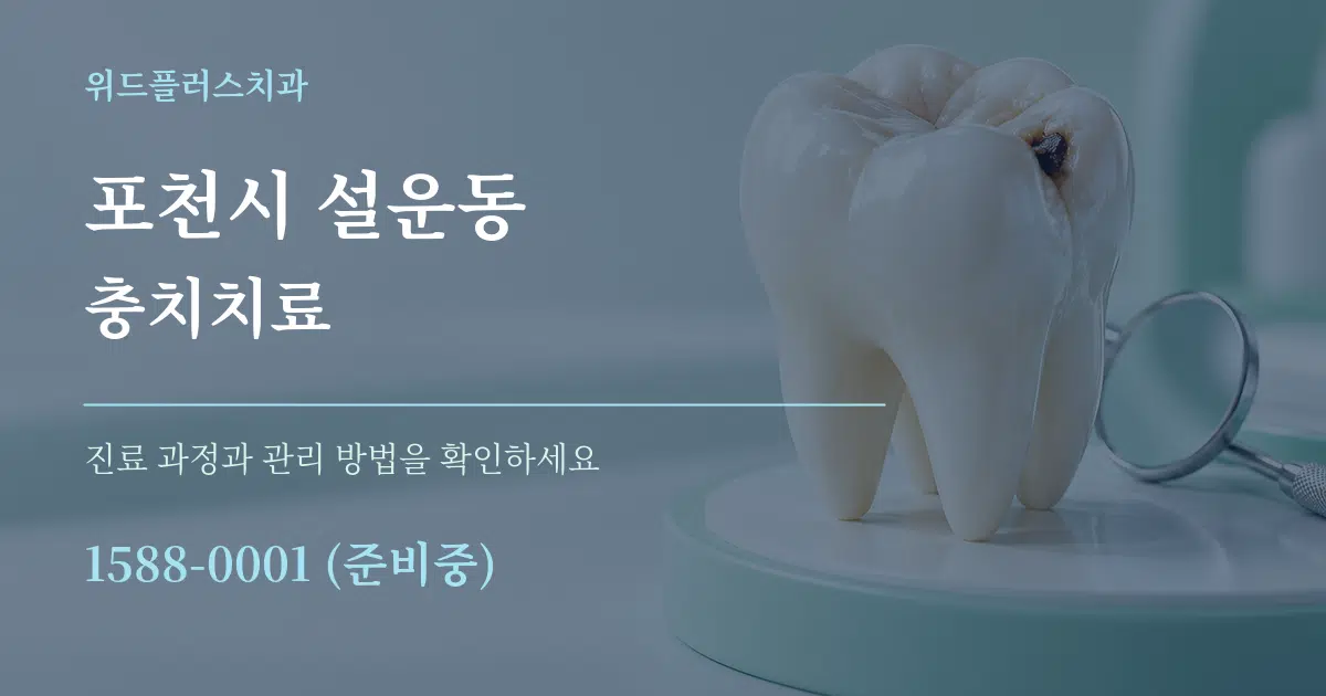 포천시 설운동 충치치료 서비스 이용 안내 그래픽