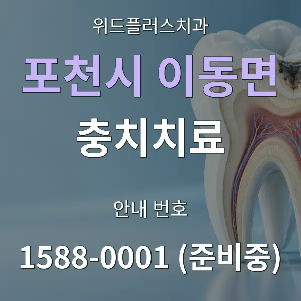 포천시 이동면 충치치료 대표 안내 그래픽