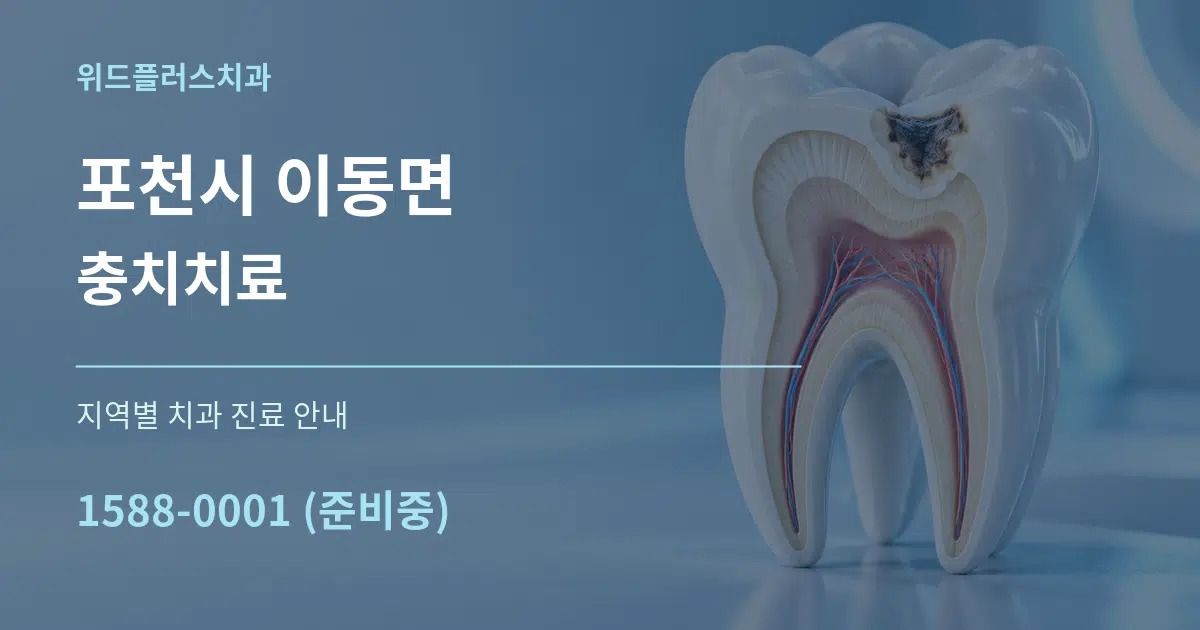 포천시 이동면 충치치료 대표 안내 그래픽