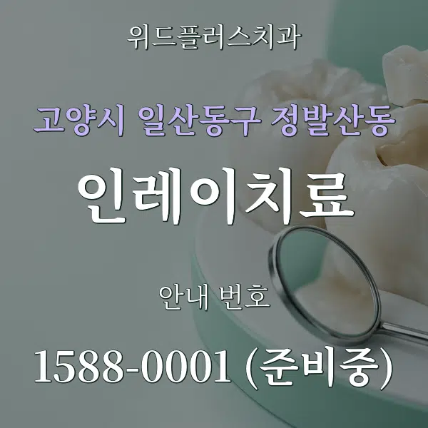 고양시 일산동구 정발산동 인레이치료 대표 안내 그래픽
