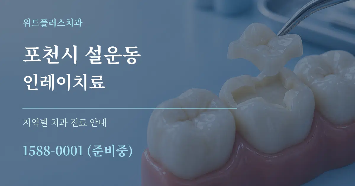 포천시 설운동 인레이치료 대표 안내 그래픽