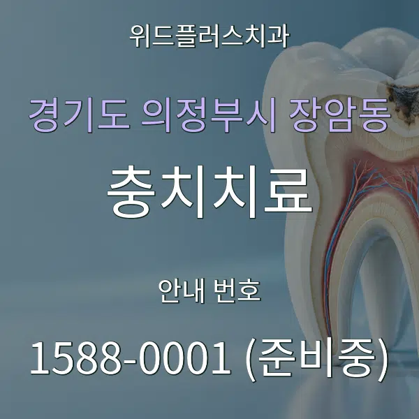 경기도 의정부시 장암동 충치치료 대표 안내 그래픽