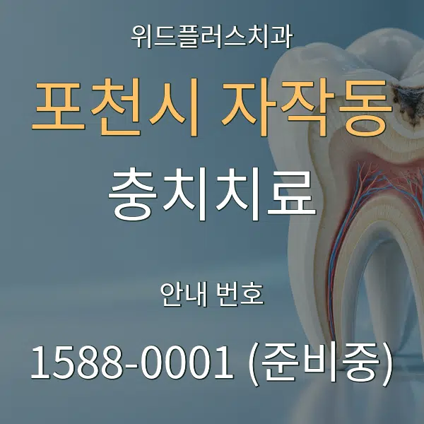 포천시 자작동 충치치료 대표 안내 그래픽