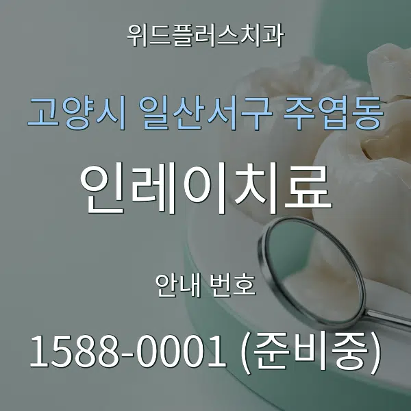 고양시 일산서구 주엽동 인레이치료 대표 안내 그래픽