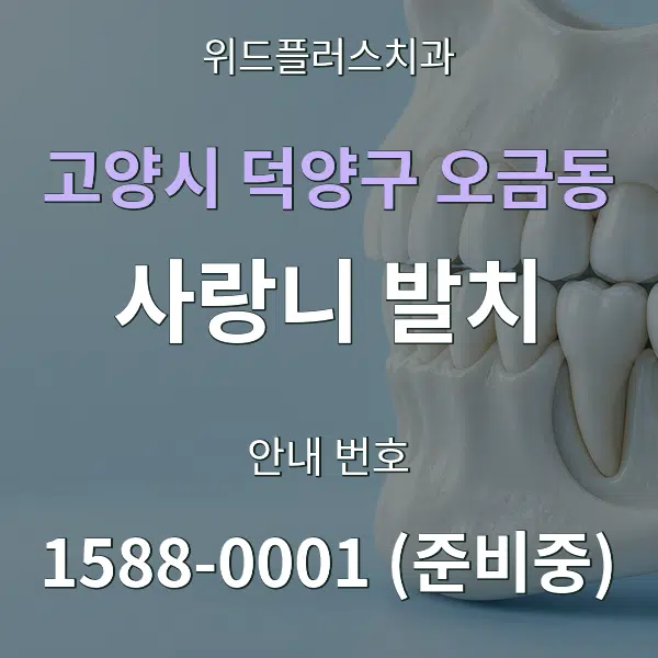 고양시 덕양구 오금동 사랑니 발치 대표 안내 그래픽