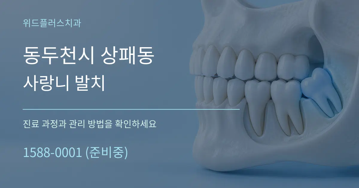 동두천시 상패동 사랑니 발치 작업 조건 안내 그래픽