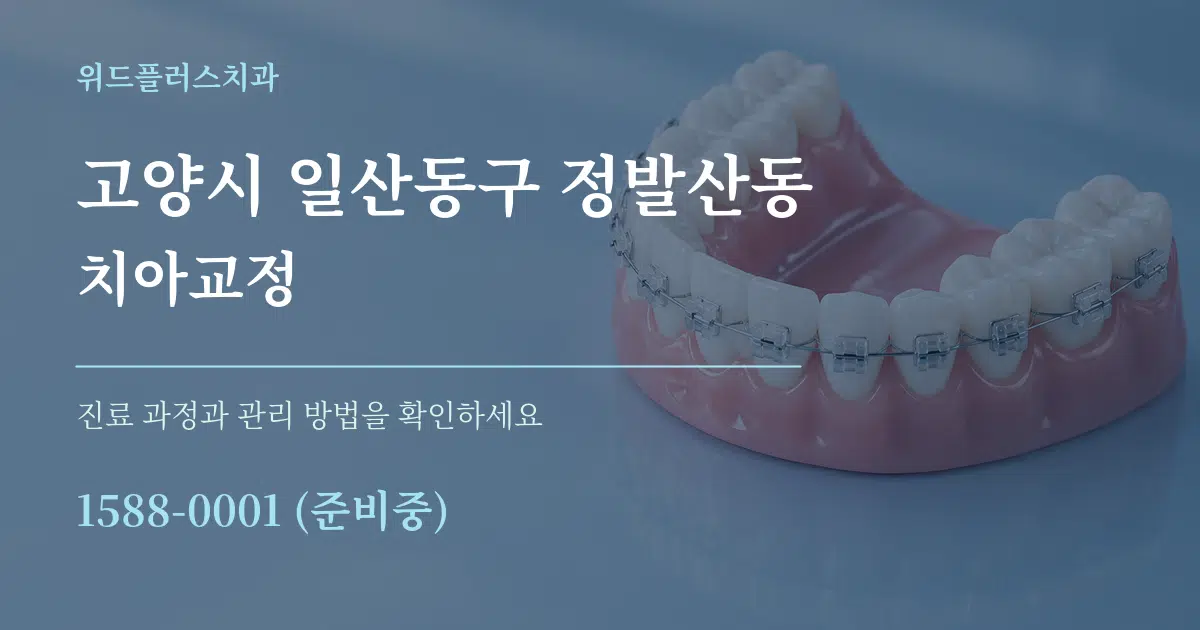 고양시 일산동구 정발산동 치아교정 작업 조건 안내 그래픽