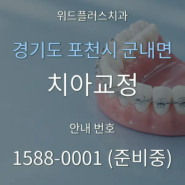 경기도 포천시 군내면 치아교정 대표 안내 그래픽