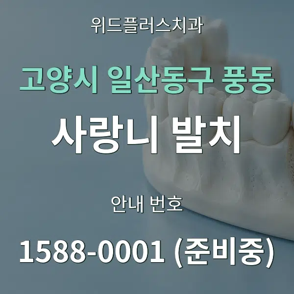 고양시 일산동구 풍동 사랑니 발치 대표 안내 그래픽