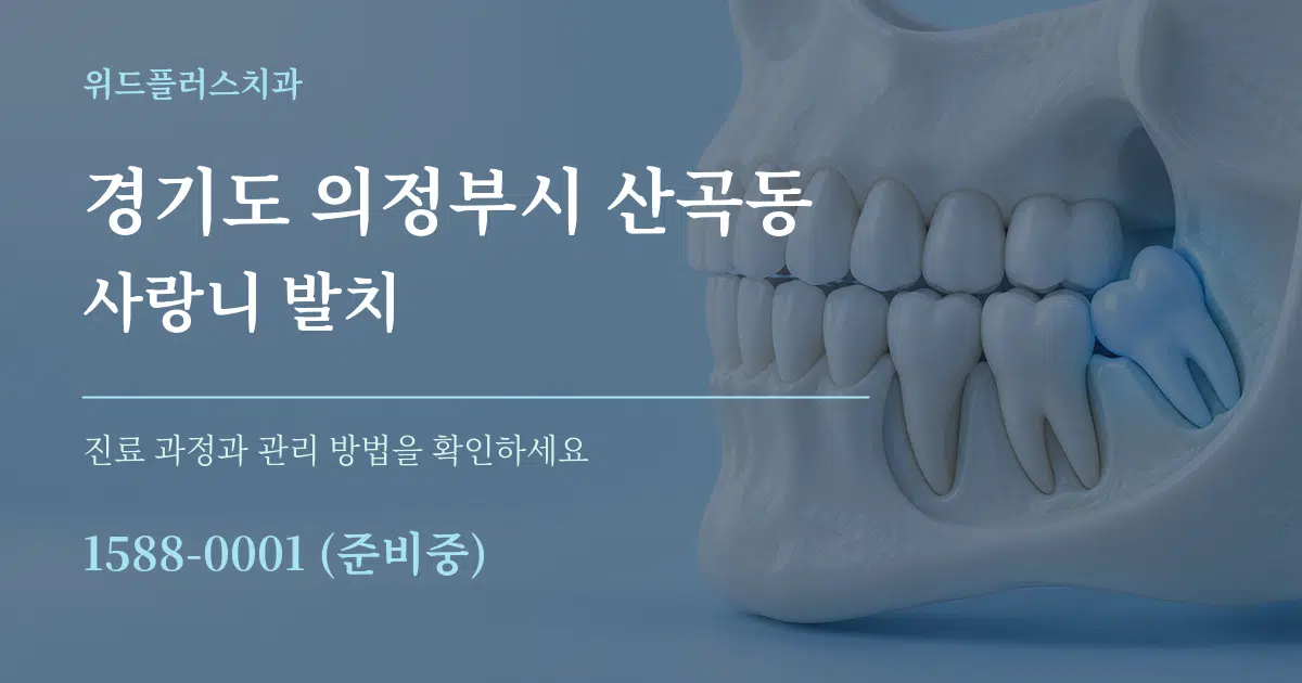경기도 의정부시 산곡동 사랑니 발치 서비스 이용 안내 그래픽