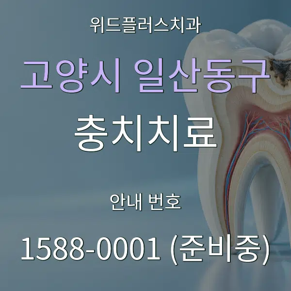 고양시 일산동구 충치치료 대표 안내 그래픽