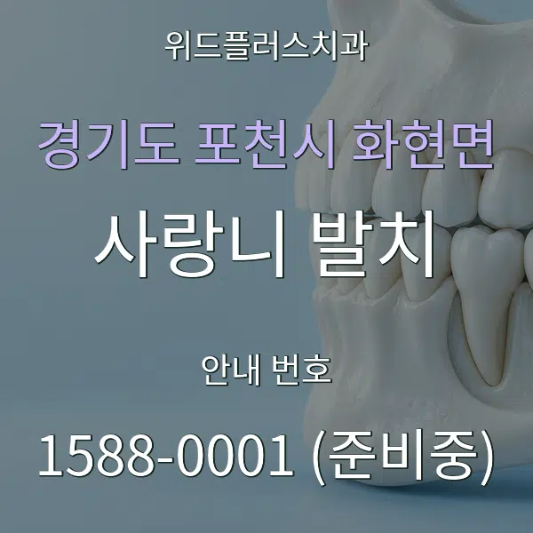 경기도 포천시 화현면 사랑니 발치 대표 안내 그래픽