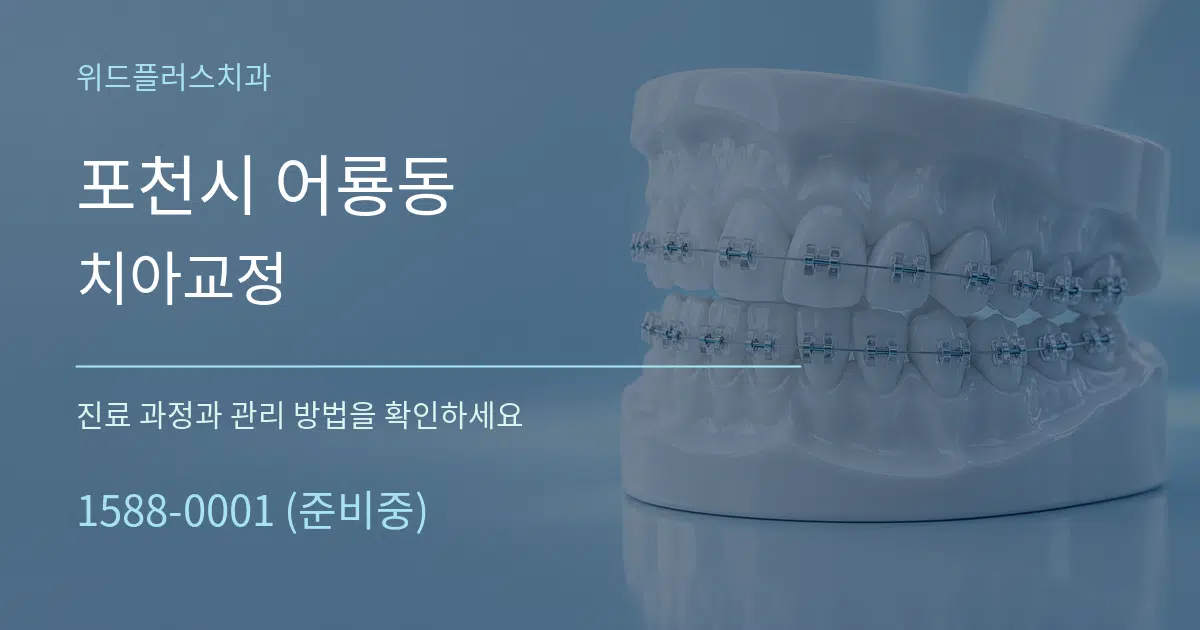 포천시 어룡동 치아교정 작업 조건 안내 그래픽