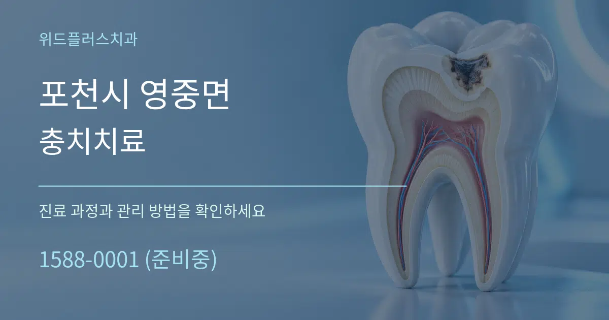 포천시 영중면 충치치료 서비스 이용 안내 그래픽