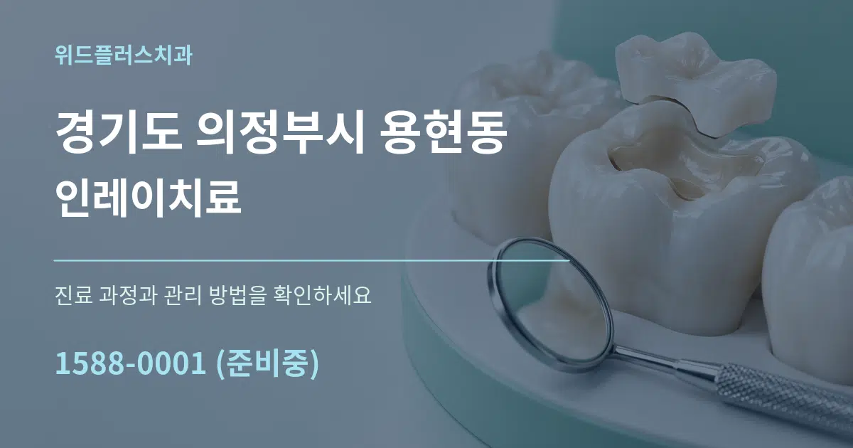 경기도 의정부시 용현동 인레이치료 서비스 이용 안내 그래픽